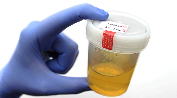 Urinalysis - sample collection - Gribbles Veterinary